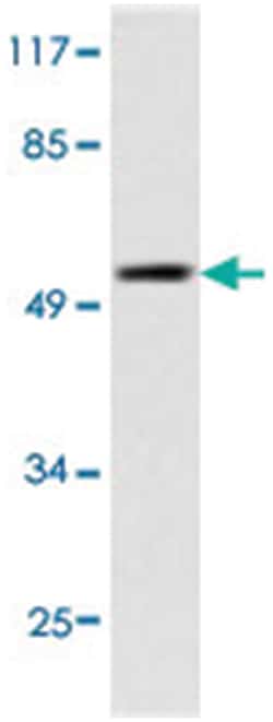 TP53 Rabbit anti-Human, Polyclonal Antibody, Abnova 100 &mu;L | Buy Online | Abnova Corporation | Fisher Scientific