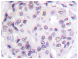 TP53 Rabbit anti-Human, Polyclonal Antibody, Abnova 100 &mu;L | Buy Online | Abnova Corporation | Fisher Scientific