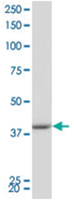 PBK Rabbit anti-Human, Polyclonal Antibody, Abnova 100 &mu;L | Buy Online | Abnova Corporation | Fisher Scientific