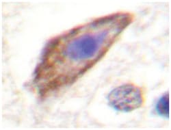 PBK Rabbit anti-Human, Polyclonal Antibody, Abnova 100 &mu;L | Buy Online | Abnova Corporation | Fisher Scientific