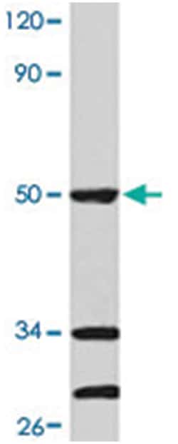 CASP9 Rabbit anti-Human, Polyclonal Antibody, Abnova 100&mu;L; Unlabeled:Antibodies,