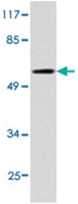 ICAM3 Rabbit anti-Human, Polyclonal Antibody, Abnova 100 &mu;L | Buy Online | Abnova Corporation | Fisher Scientific