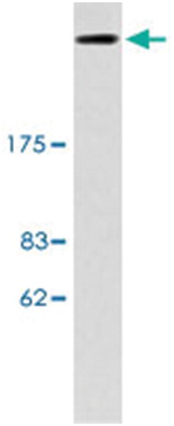 EP300 Rabbit anti-Human, Polyclonal Antibody, Abnova 100 &mu;L | Buy Online | Abnova Corporation | Fisher Scientific