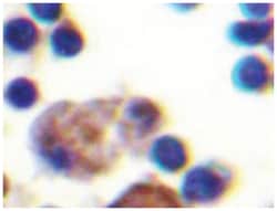 IL9R Rabbit anti-Human, Polyclonal Antibody, Abnova 100 &mu;L | Buy Online | Abnova Corporation | Fisher Scientific