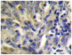 CSTA, Rabbit, Polyclonal Antibody, Abnova 100&mu;L; Unlabeled:Antibodies,