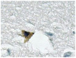 GRB10 Rabbit anti-Human, Polyclonal Antibody, Abnova 100 &mu;L | Buy Online | Abnova Corporation | Fisher Scientific