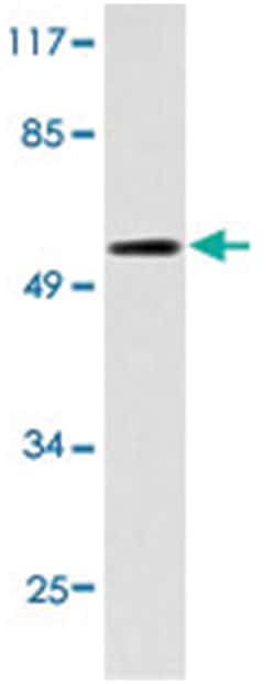IL2RA Rabbit anti-Human, Polyclonal Antibody, Abnova 100 &mu;L | Buy Online | Abnova Corporation | Fisher Scientific