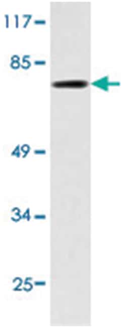 IRAK1 Rabbit anti-Human, Polyclonal Antibody, Abnova 100 &mu;L | Buy Online | Abnova Corporation | Fisher Scientific