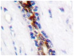 IRAK1 Rabbit anti-Human, Polyclonal Antibody, Abnova 100 &mu;L | Buy Online | Abnova Corporation | Fisher Scientific