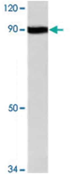 PGR Rabbit anti-Human, Polyclonal Antibody, Abnova 100 &mu;L | Buy Online | Abnova Corporation | Fisher Scientific