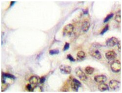 PGR Rabbit anti-Human, Polyclonal Antibody, Abnova 100 &mu;L | Buy Online | Abnova Corporation | Fisher Scientific