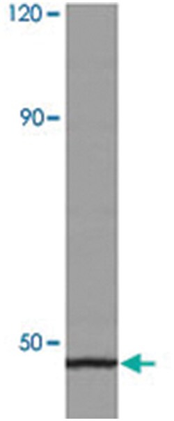 VDR Rabbit anti-Human, Polyclonal Antibody, Abnova 100 &mu;L | Buy Online | Abnova Corporation | Fisher Scientific