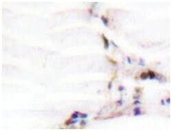 VDR Rabbit anti-Human, Polyclonal Antibody, Abnova 100 &mu;L | Buy Online | Abnova Corporation | Fisher Scientific