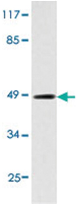 IKBKG Rabbit anti-Human, Polyclonal Antibody, Abnova 100 &mu;L | Buy Online | Abnova Corporation | Fisher Scientific