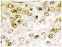 CHEK1 Rabbit anti-Human, Polyclonal Antibody, Abnova 100 &mu;L | Buy Online | Abnova Corporation | Fisher Scientific