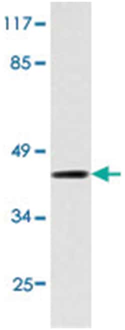 IKBKG Rabbit anti-Human, Polyclonal Antibody, Abnova 100 &mu;L | Buy Online | Abnova Corporation | Fisher Scientific