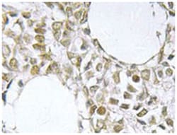 IKBKG Rabbit anti-Human, Polyclonal Antibody, Abnova 100 &mu;L | Buy Online | Abnova Corporation | Fisher Scientific