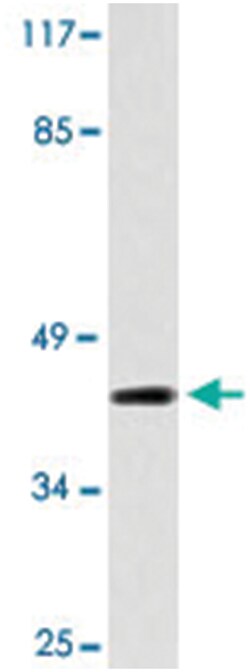 NCF1 Rabbit anti-Human, Polyclonal Antibody, Abnova 100 &mu;L | Buy Online | Abnova Corporation | Fisher Scientific