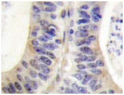 NCF1 Rabbit anti-Human, Polyclonal Antibody, Abnova 100 &mu;L | Buy Online | Abnova Corporation | Fisher Scientific