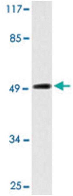 SUPT3H Rabbit anti-Human, Polyclonal Antibody, Abnova 100 &mu;L | Buy Online | Abnova Corporation | Fisher Scientific