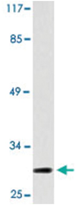 PTTG1/PTTG2/PTTG3P, Rabbit, Polyclonal Antibody, Abnova 100&mu;L; Unlabeled:Antibodies,