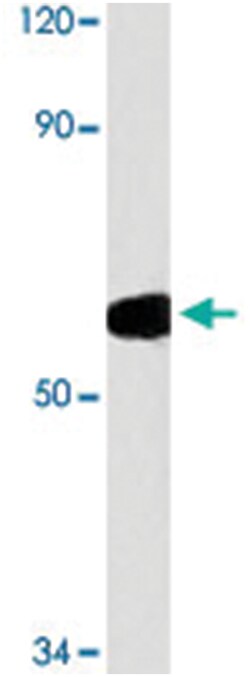 TLE2, Rabbit, Polyclonal Antibody, Abnova 100 &mu;L | Buy Online | Abnova Corporation | Fisher Scientific