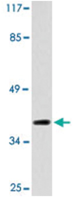 CDK5R2, Rabbit, Polyclonal Antibody, Abnova 100 &mu;L | Buy Online | Abnova Corporation | Fisher Scientific