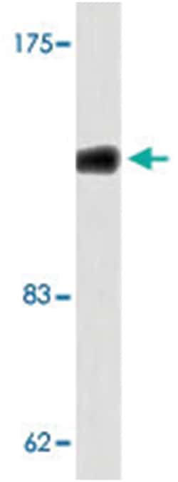 DGKD Rabbit anti-Human, Polyclonal Antibody, Abnova 100&mu;L; Unlabeled:Antibodies,
