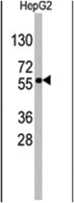 SOX9 Rabbit anti-Human, Polyclonal Antibody, Abnova 400 &mu;L | Buy Online | Abnova Corporation | Fisher Scientific