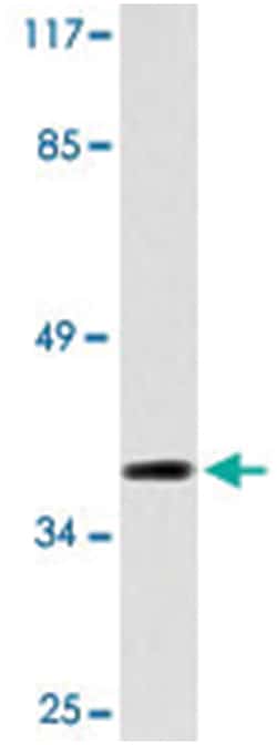 HTR5A Rabbit anti-Human, Polyclonal Antibody, Abnova 100 &mu;L | Buy Online | Abnova Corporation | Fisher Scientific