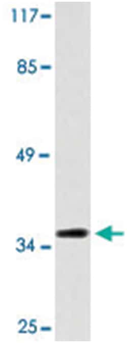 TP53I3 Rabbit anti-Human, Polyclonal Antibody, Abnova 100 &mu;L | Buy Online | Abnova Corporation | Fisher Scientific