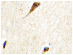 AGER Rabbit anti-Human, Polyclonal Antibody, Abnova 100 &mu;L | Buy Online | Abnova Corporation | Fisher Scientific