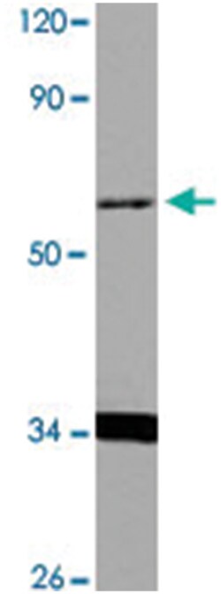 TBX22, Rabbit, Polyclonal Antibody, Abnova 100 &mu;L | Buy Online | Abnova | Fisher Scientific