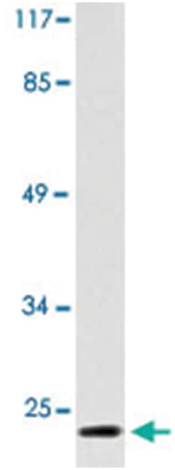 COX4I1 Rabbit anti-Human, Polyclonal Antibody, Abnova 100 &mu;L | Buy Online | Abnova Corporation | Fisher Scientific
