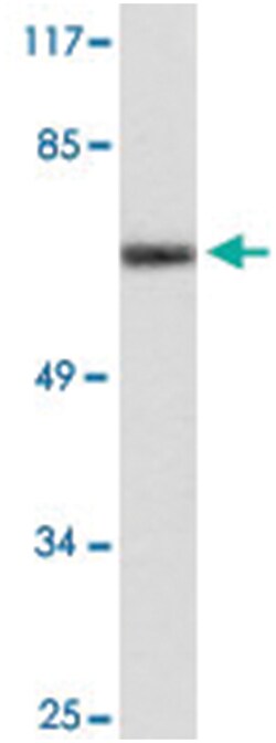 CYP24A1, Rabbit, Polyclonal Antibody, Abnova 100 &mu;L | Buy Online | Abnova Corporation | Fisher Scientific