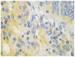 CYP24A1, Rabbit, Polyclonal Antibody, Abnova 100 &mu;L | Buy Online | Abnova Corporation | Fisher Scientific