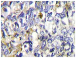 CYP27A1, Rabbit, Polyclonal Antibody, Abnova 100&mu;L; Unlabeled:Antibodies,