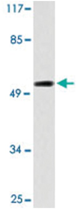 CYP2A13, Rabbit, Polyclonal Antibody, Abnova 100 &mu;L | Buy Online | Abnova | Fisher Scientific