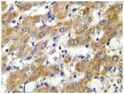 CYP2C8/CYP2C9/CYP2C18/CYP2C19, Rabbit, Polyclonal Antibody, Abnova 100&mu;L;