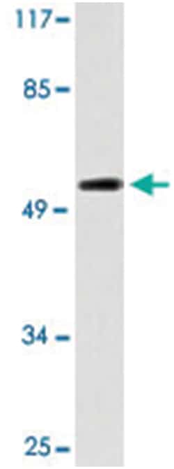 CYP3A4/CYP3A5, Rabbit, Polyclonal Antibody, Abnova 100&mu;L; Unlabeled:Antistoffer