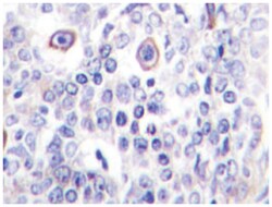 CD83, Rabbit, Polyclonal Antibody, Abnova 100 &mu;L | Buy Online | Abnova Corporation | Fisher Scientific