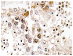 FOXL1, Rabbit, Polyclonal Antibody, Abnova 100 &mu;L | Buy Online | Abnova Corporation | Fisher Scientific