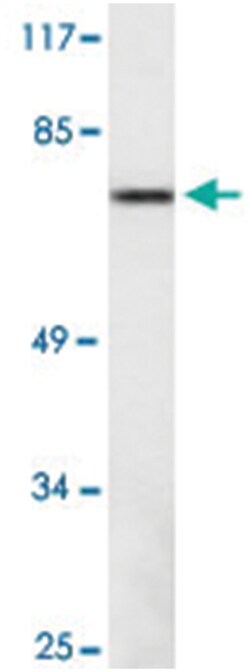 MELK Rabbit anti-Human, Polyclonal Antibody, Abnova 100&mu;L; Unlabeled:Antibodies,