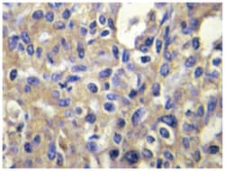 MELK Rabbit anti-Human, Polyclonal Antibody, Abnova 100&mu;L; Unlabeled:Antibodies,