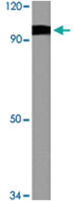 DBC1, Rabbit, Polyclonal Antibody, Abnova 100 &mu;L | Buy Online | Abnova Corporation | Fisher Scientific