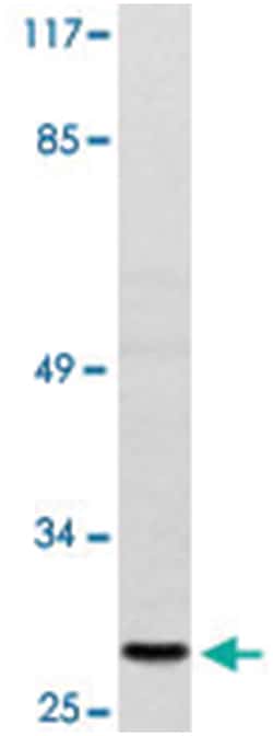 DUSP19, Rabbit, Polyclonal Antibody, Abnova 100&mu;L; Unlabeled:Antibodies,