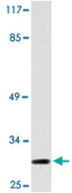 HES6, Rabbit, Polyclonal Antibody, Abnova 100&mu;L; Unlabeled:Antibodies,