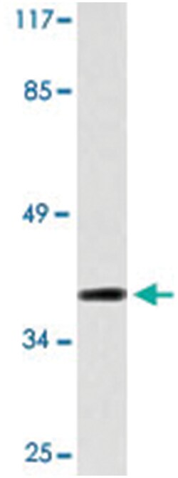 ARR3, Rabbit, Polyclonal Antibody, Abnova 100 &mu;L | Buy Online | Abnova Corporation | Fisher Scientific