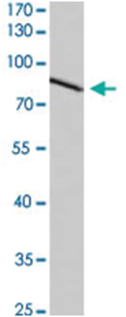 CDH17, Rabbit, Polyclonal Antibody, Abnova 100 &mu;L | Buy Online | Abnova Corporation | Fisher Scientific