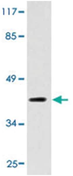 BRS3 Rabbit anti-Human, Polyclonal Antibody, Abnova 100 &mu;L | Buy Online | Abnova Corporation | Fisher Scientific